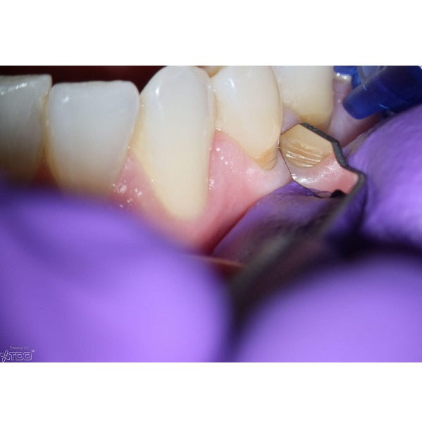 Carr Micromirror - 3x6mm Oval